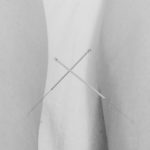 Les points d’acupuncture